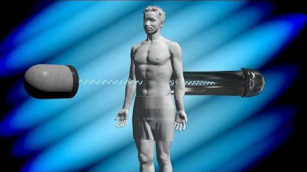 Video How Does a CT Scan Work?   türkçe