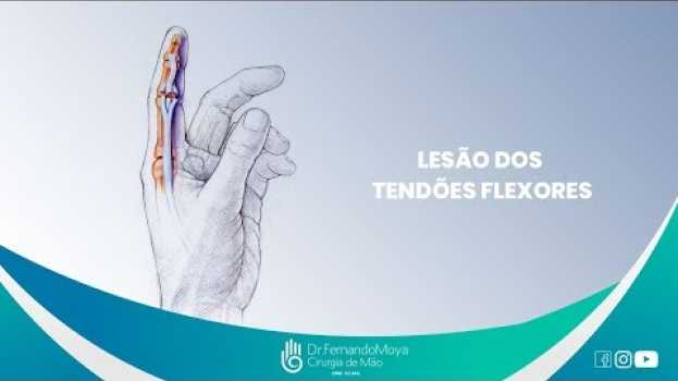 Video Lesão dos tendões flexores | Dr. Fernando Moya CRM 112.046 po polsku