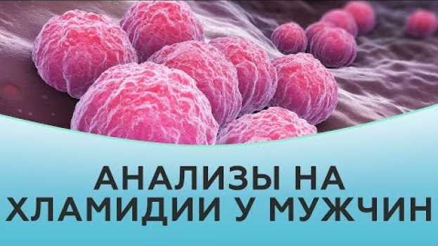 Video Анализы на хламидии у мужчин   türkçe