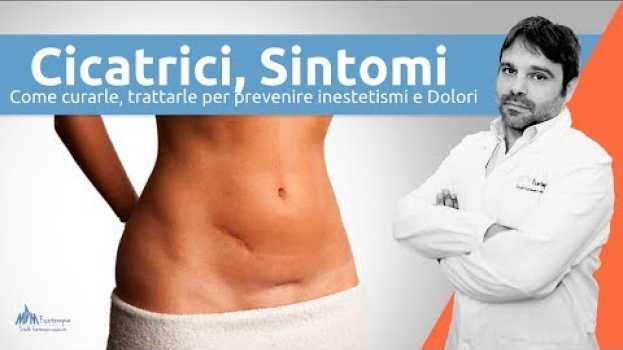 Video Cicatrici, cosa sono, sintomi e come si trattano e curano DEFINITAMENTE en español