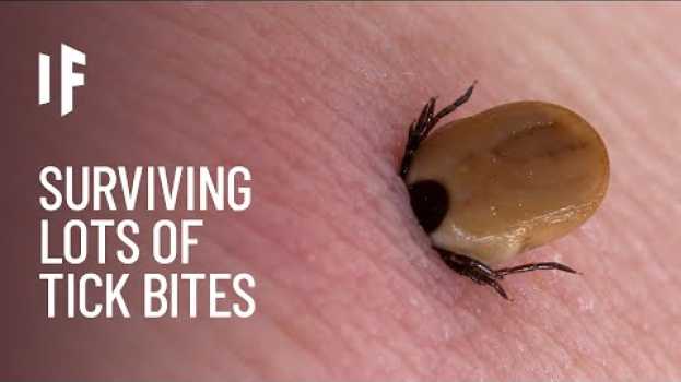 Video What If You Were Bitten by One Million Ticks?   türkçe