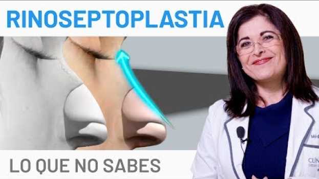 Video ¿Qué es la Rinoseptoplastia y en qué pacientes está indicado? po polsku