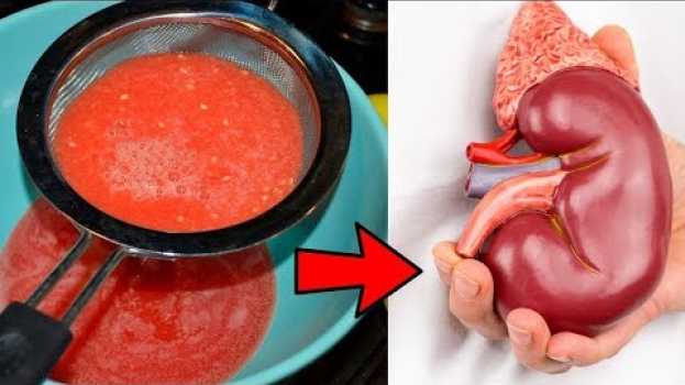 Video Como Desintoxicar Seus Rins Naturalmente com Esta Receita en español