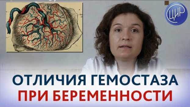 Video Гемостаз при беременности. Кровообращение при беременности и плацента человека. en français