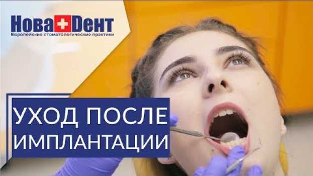 Video 🔴 Важные рекомендации после имплантации зубов. Рекомендации после имплантации. НоваДент. 12+ po polsku