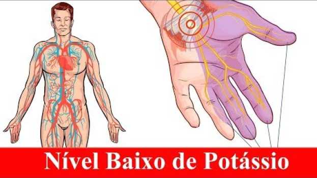 Video Potássio Baixo? 5 Sinais e Como Melhorar Isso en español