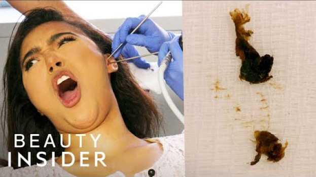 Video How Earwax Is Professionally Extracted | Beauty Explorers | Insider Beauty   türkçe
