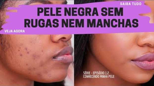 Video SÉRIE 1.2 - PELE NEGRA SEM RUGAS NEM MANCHAS - Conheça sua pele su italiano