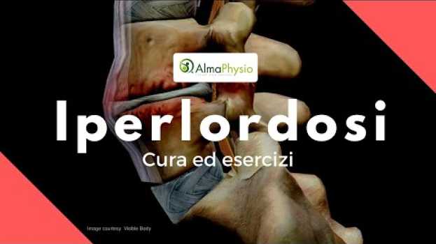 Video iperlordosi cura ed esercizi en français