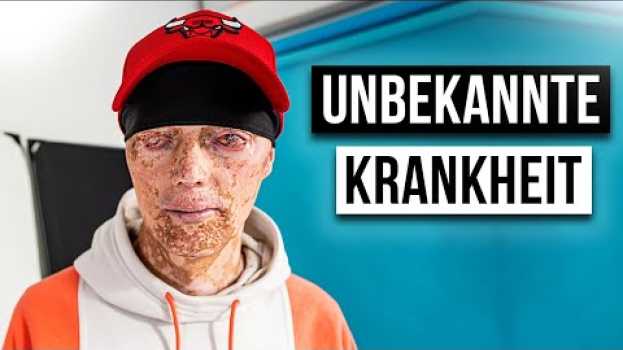 Video Wie ist das EINE UNBEKANNTE KRANKHEIT ZU HABEN?   türkçe