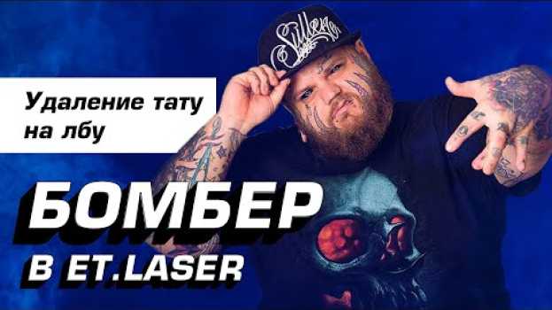 Video БОМБЕР! УДАЛЯЕМ ТАТУ СО ЛБА ЛАЗЕРОМ ЗА 15.000.000 руб!!! КОНКУРС НА УДАЛЕНИЕ ТАТУ! auf Deutsch