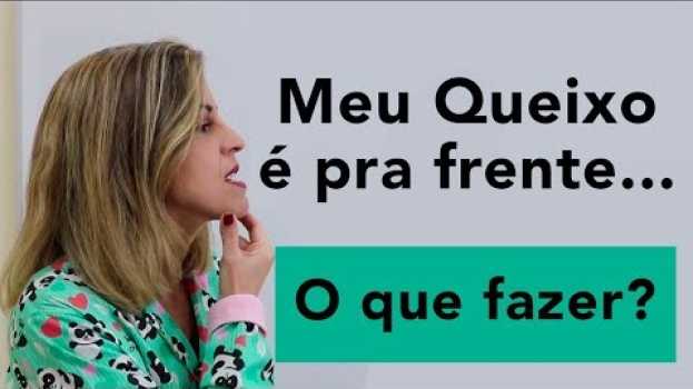 Video Queixo pra frente tem aparelho que resolve? | Aparelho Móvel | Ortopedia | DentalKids su italiano