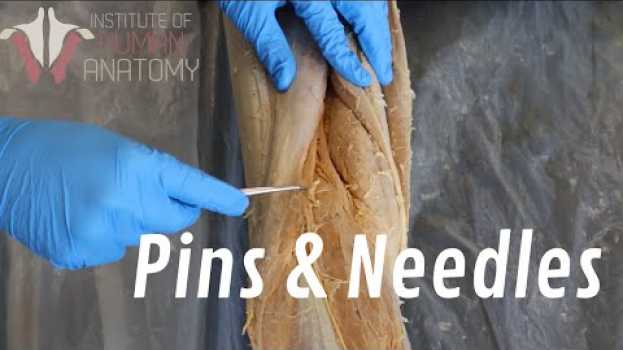 Video What Are "Pins & Needles"?? po polsku