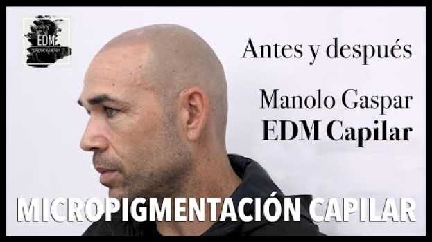 Video Manolo Gaspar, futbolista profesional - Antes y después de la micropigmentación capilar auf Deutsch