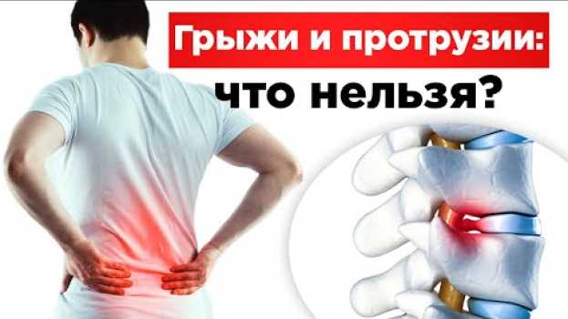 Video Протрузии и грыжи. Что нельзя? po polsku