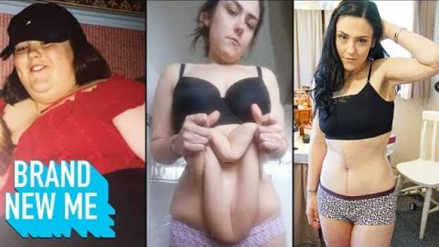 Video I Lost 140lbs And Finally Had My Extreme Excess Skin Removed | BRAND NEW ME en español