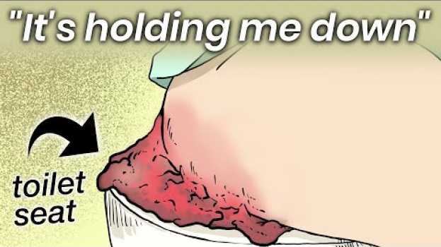 Video The Woman Who Was Stuck to a Toilet Seat for 2 Years em português