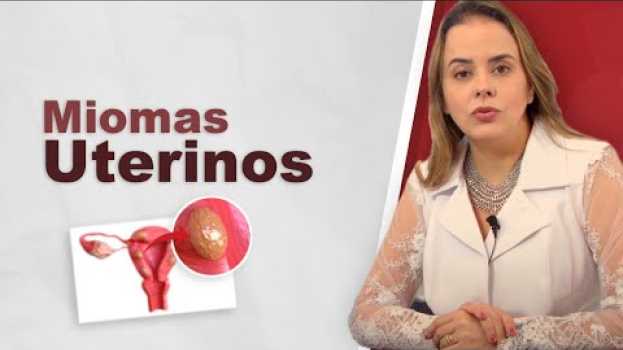 Видео Miomas uterinos. Leiomiomas no útero. Mal muito frequente. на русском