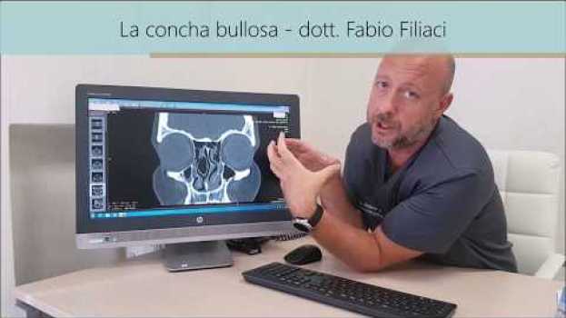 Video Conca bullosa (più correttamente Concha bullosa); cos’è e cosa comporta? in English