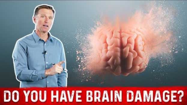Video Quick Way to Know if You Have Brain Damage em português