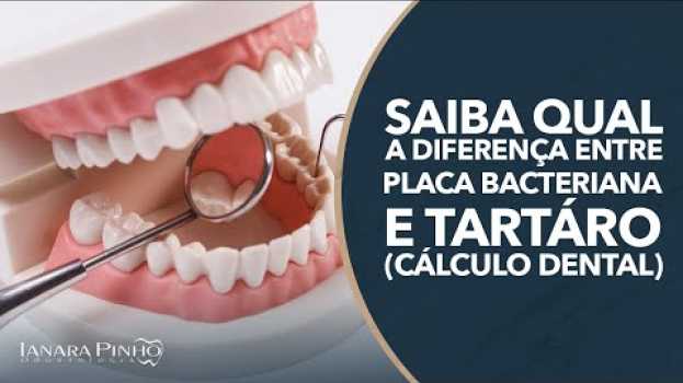 Video Saiba Qual a Diferença entre Placa Bacteriana e Tártaro (Cálculo Dental) | Ianara Pinho po polsku