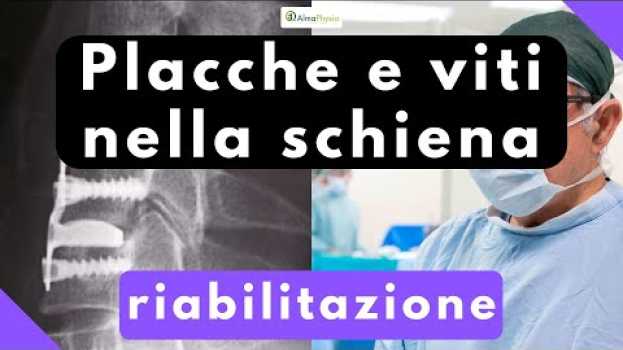 Видео Placche e viti nella schiena: riabilitazione на русском
