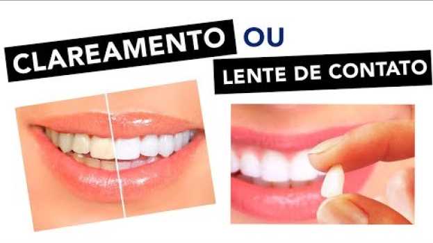 Video Clareamento  ou lente de contato, qual é o melhor? po polsku
