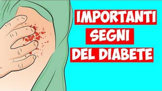 Video I 10 SEGNI DEL DIABETE CHE TUTTI DOVREBBERO CONOSCERE. NON IGNORARLI! en español