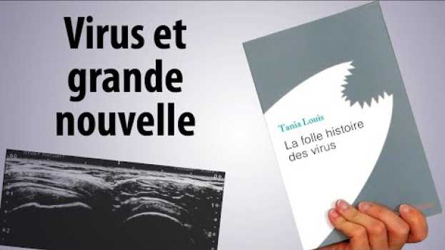 Video Virus et grande nouvelle auf Deutsch