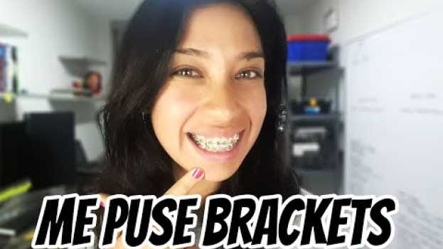 Video Brackets a los 30 años | Femynna po polsku