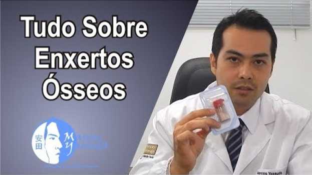 Video Tudo sobre exertos ósseos, Conheça os tipos de enxertos e suas aplicações en français