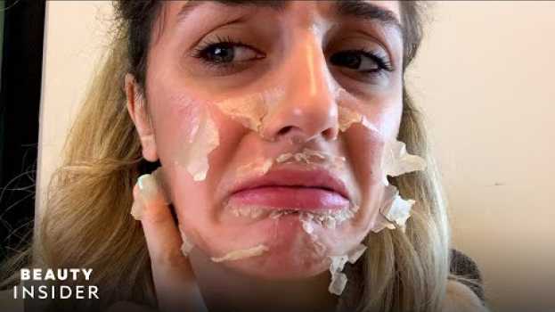 Video What It’s Like To Get A Chemical Peel For Acne Scars | Beauty Explorers | Beauty Insider en español