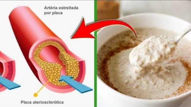 Video Isso é o Que Acontece Com Seu Corpo Depois de COMER AVEIA   türkçe
