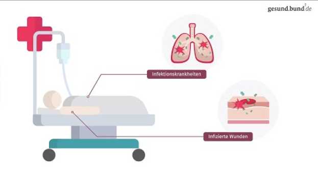 Video Was ist eine Sepsis? en français