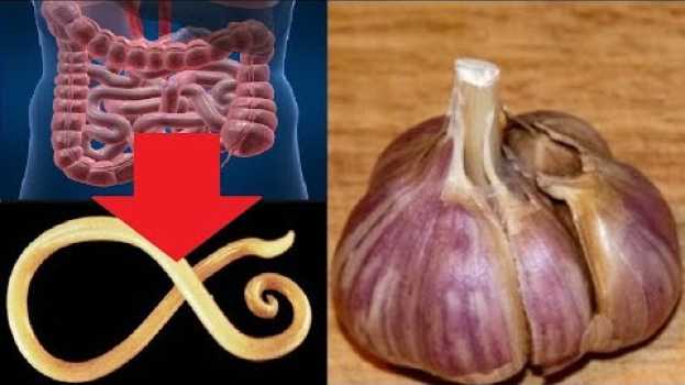 Video Vedi cosa succede se mangi l'aglio a stomaco vuoto! en español