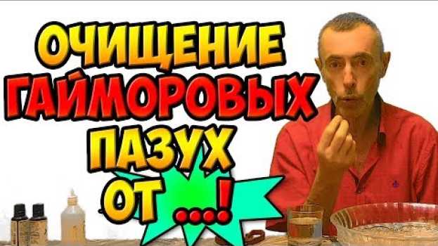 Video ОЧИЩЕНИЕ ГАЙМОРОВЫХ ПАЗУХ ОТ ...! Виталий Островский. Грипп, простуда, гайморит, гипотиреоз. su italiano