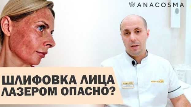Video 🔥Лазерная шлифовка лица 🔥ОПАСНО?🔥 Восстановление, ДО и После in English
