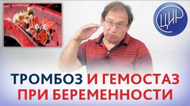 Video Гемостаз и тромбоз при беременности. ВЯЗКОСТЬ и СВЁРТЫВАЕМОСТЬ крови. Рассказывает Гузов И.И.   türkçe