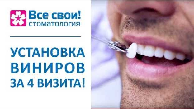Video 💎  Этапы установки виниров, виды и особенности. Установка виниров этапы. Стоматология Все Свои. 12+   türkçe