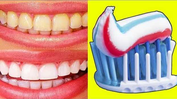 Video 5 Novas Formas de COMO CLAREAR OS DENTES Só Em 1 Dia po polsku