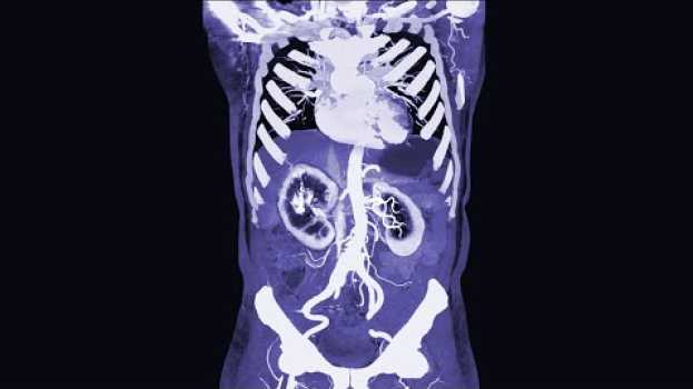 Video A Man Ate 2 Pounds Licorice Candy. This Is What Happened To His Organs. en français