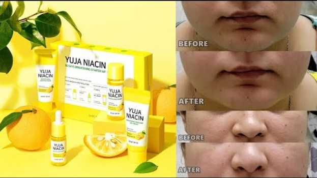 Video SOME BY MI Yuja Niacin 30 Days Brightening Starter Kit Review 🍋  | Korean Skincare | K-BEAUTY po polsku