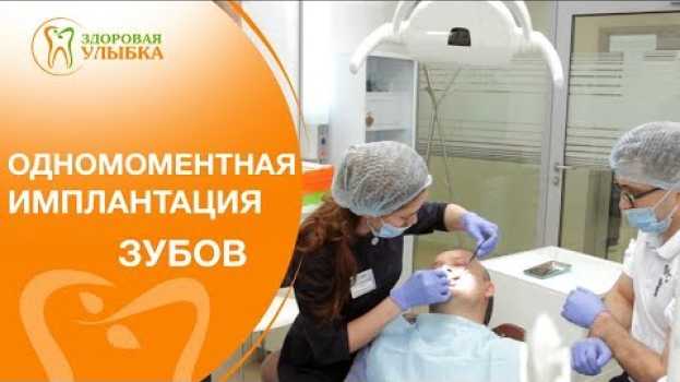 Video Имплантация сразу после удаления зуба. 👌 Как проходит имплантация сразу после удаления зуба? en español