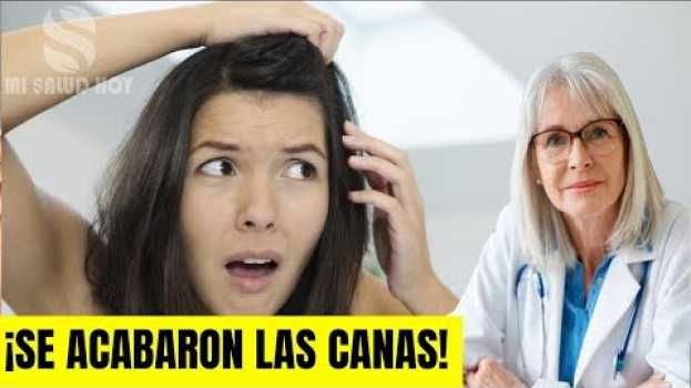 Video 🔵ENTERATE DE COMO CONTROLAR LA CAÍDA DEL CABELLO PARA SIEMPRE Y DILE ADIOS A LAS CANAS NATURALMENTE   türkçe