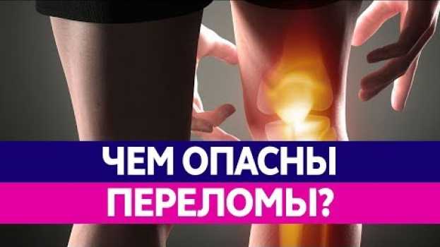Video ЧЕМ ОПАСЕН ПЕРЕЛОМ КОСТЕЙ? Лечение переломов и их последствия! in English