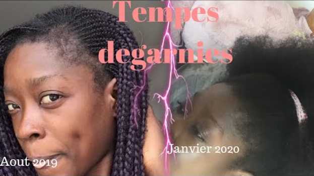 Video ALOPÉCIE : COMMENT J’AI FAIT REPOUSSER MES CHEVEUX DES TEMPES RAPIDEMENT ? AGIS DIRECTEMENT  !   türkçe