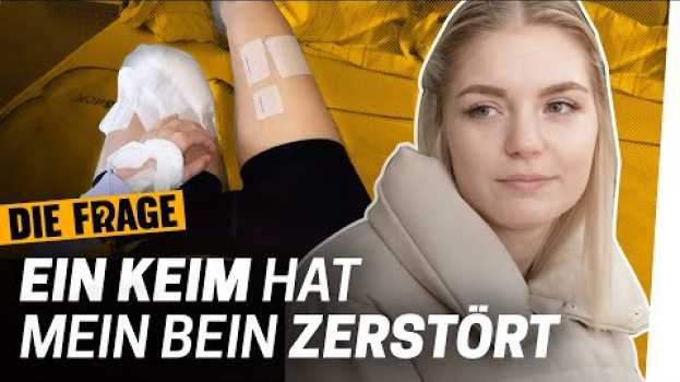 Video Amputation: 33 Operationen konnten mein Bein nicht retten | Wie komme ich mit meinem Körper klar? #6 in English