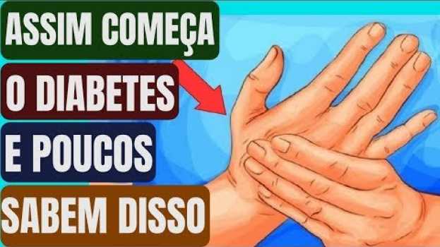 Video Se Você Tiver Algum Desses Sintomas Pode Ser Início de Diabetes E Você Nem Sabe. Fique Atento!   türkçe