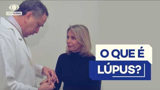 Video Você sabe o que é lúpus? Entenda causas, sintomas e tratamentos   türkçe