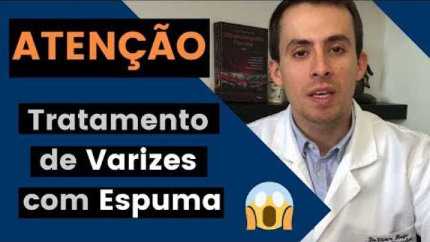 Video Tratamento de Varizes com Espuma: NÃO faça antes de ver esse vídeo. po polsku